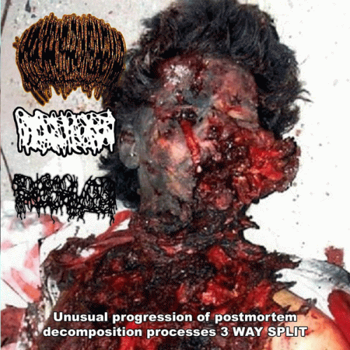 Hydrocephalus : Unusual Progression of Postmortem Decomposition Process